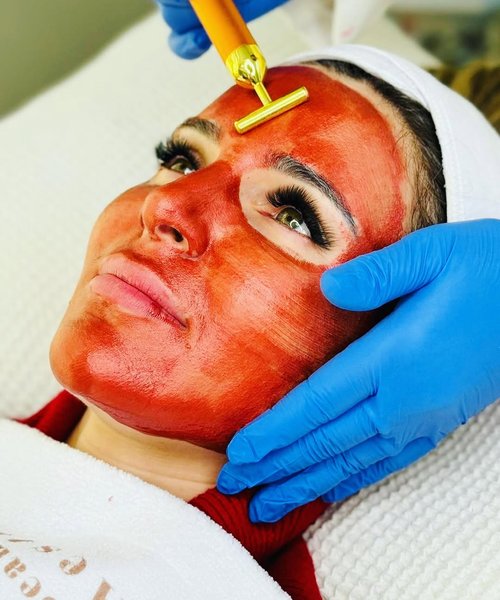PRP platelet-rich plasma facial rejuvenation treatment